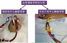 透析患者中心静脉留置导管的居家护理