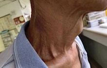 【技术推广】中西医结合，为肿瘤患者开拓生命绿洲