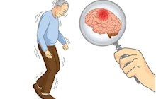  老患者突发脑血管意外，中医院静脉溶栓打开“生命之路”