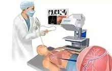 高烧肺炎惹人恼？纤支镜揪出真凶！