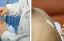 三伏天采阳，中医院推荐两个法子→